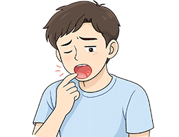 구강아프타